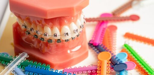 pierwsza wizyta u ortodonty i wybór rodzaju aparatu